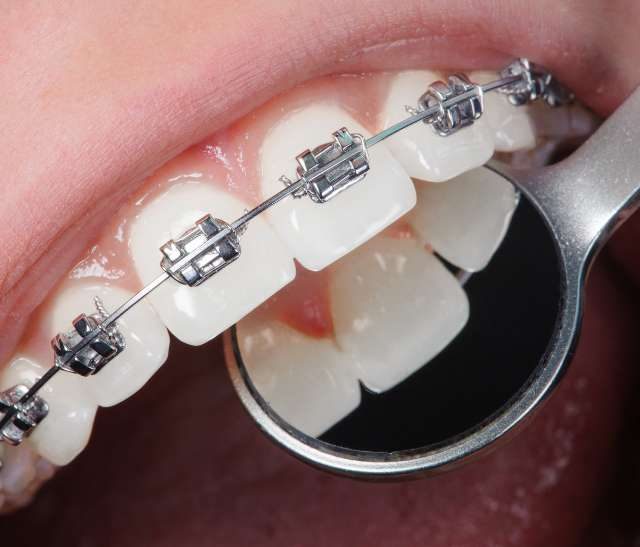 Beneficios de la impresión 3D en el laboratorio dental (1)